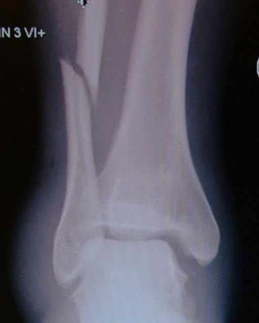 Close-up of X-ray