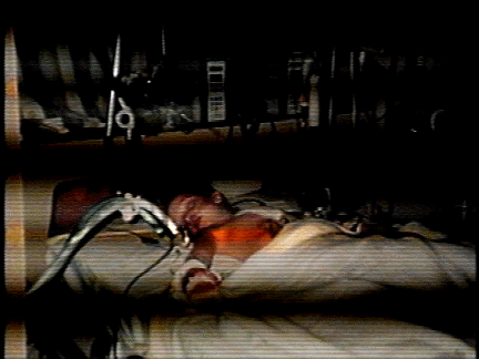 image processed with sound of young child dying on hospital bed